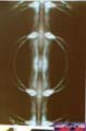 N#:263078 - 